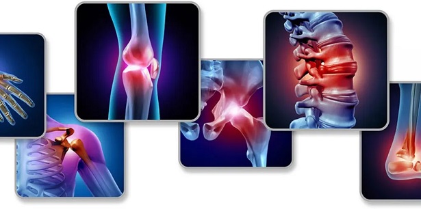 Physiotherapist helping patient with rheumatology joint exercises
