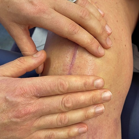 Scar therapy and massage services